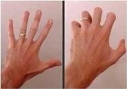 حرکات کششی پیشگیرانه در محل کار